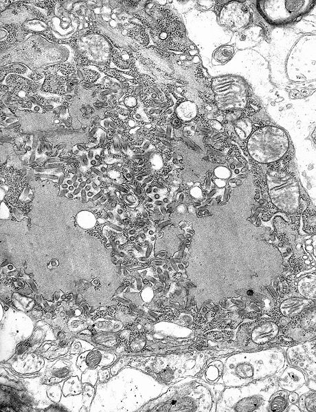 460px-rabies virus em phil 1876