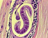 trichinella-musc-chmai